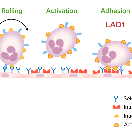 Leukocyte Adhesion Deficiency (Type 1 and 2)
